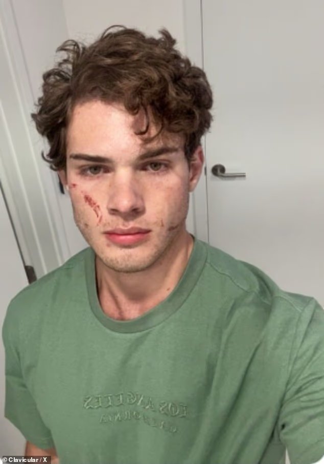 Claviculaire partage une mise à jour sur une hospitalisation «