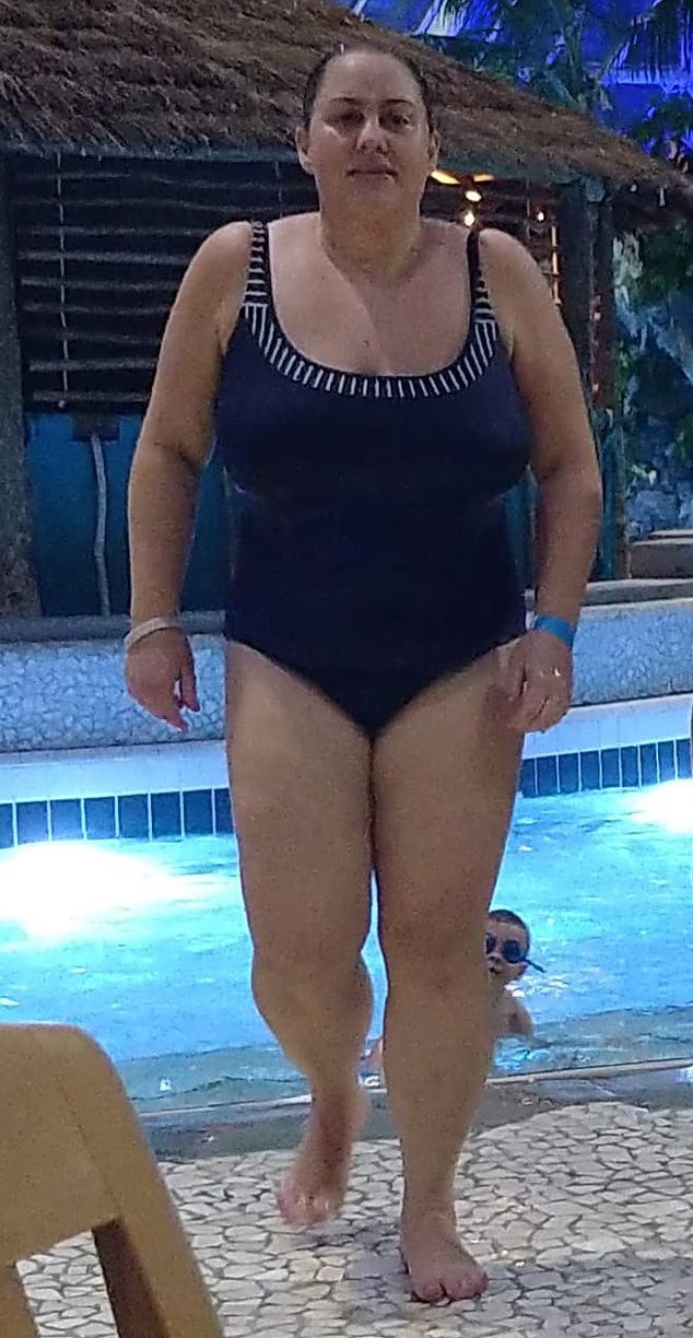 Comment j'ai perdu un calcul APRÈS avoir arrêté la greffe