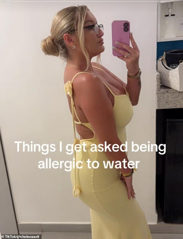 Je suis allergique à l'eau... ma propre sueur et mes