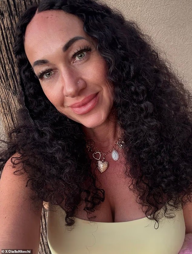 Rachel Dolezal révèle qu'elle a un cancer de la peau