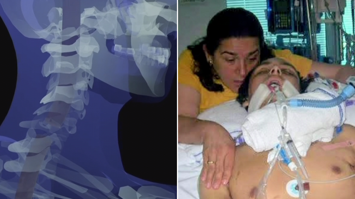 Científicos australianos tratan con éxito las lesiones cerebrales