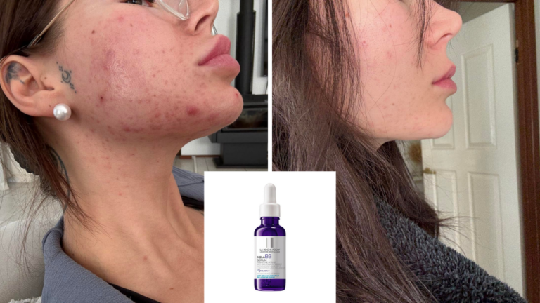 El suero para manchas oscuras probado por dermatólogos cae por