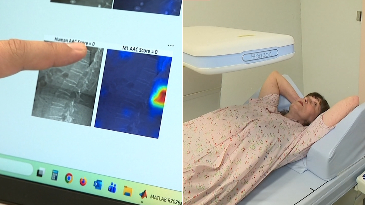 Investigadores australianos utilizan inteligencia artificial para detectar enfermedades cardíacas antes