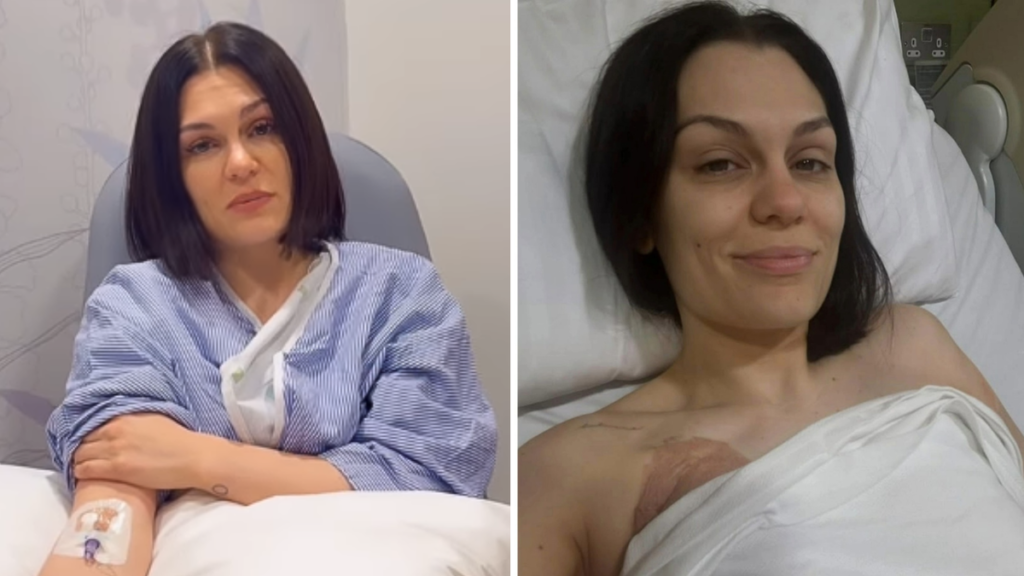 Jessie J comparte una nueva actualización de salud sobre su