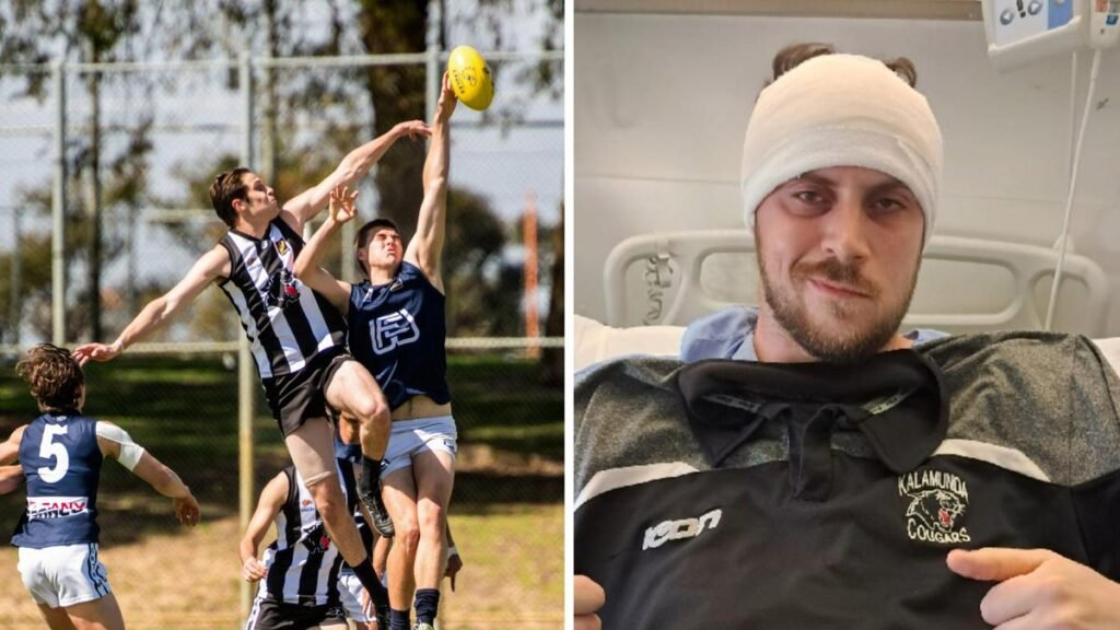 Josh Davies: un joven futbolista diagnosticado con melanoma en etapa