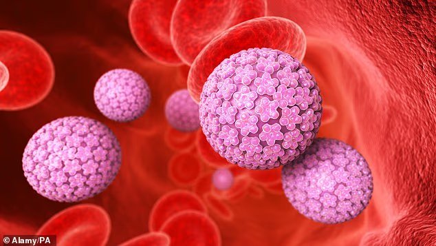 Le cancer du col de l'utérus pourrait être éradiqué au