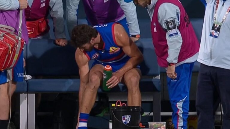 Los Western Bulldogs podrían recurrir al capitán lesionado Marcus Bontempelli
