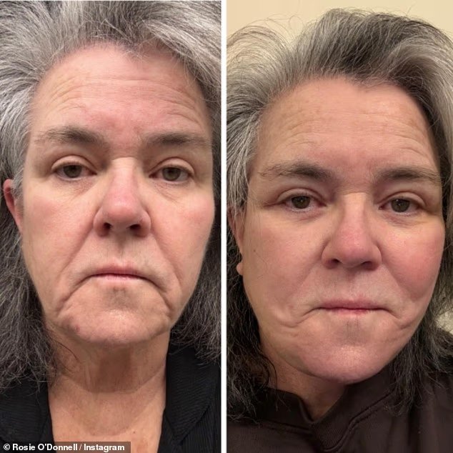 Rosie O'Donnell, 64 ans, partage des photos choquantes de son