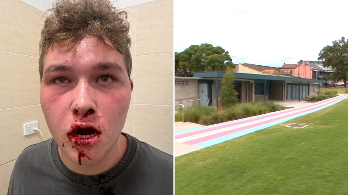 Un adolescente autista fue golpeado por una pandilla de jóvenes