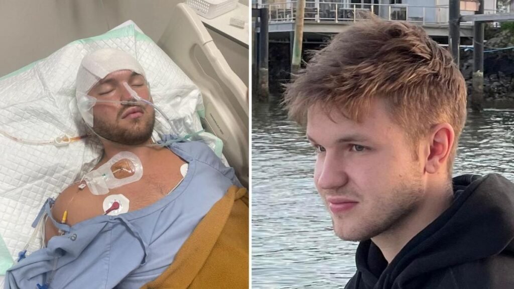 Un australiano herido en circunstancias misteriosas en Indonesia