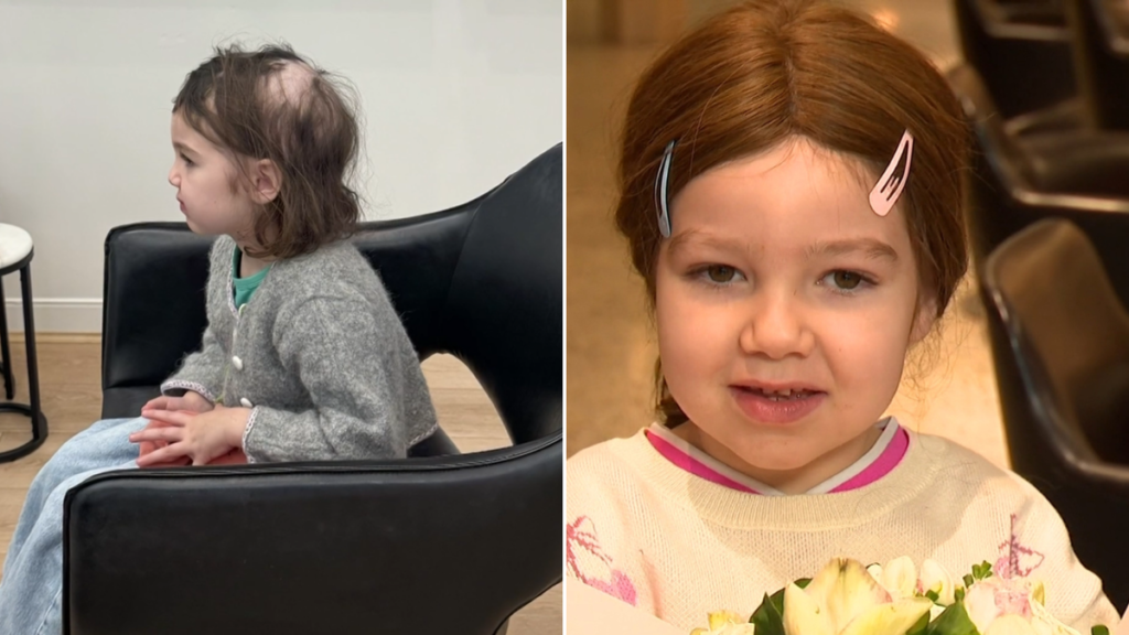 Una niña de Sydney con alopecia recibe un regalo que