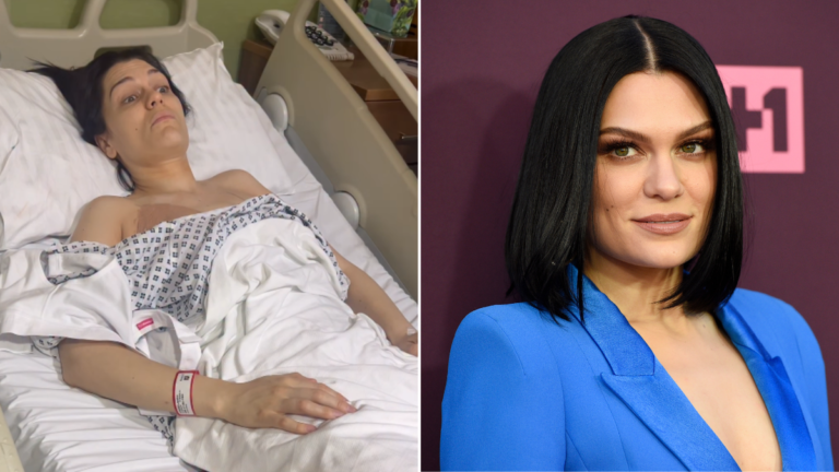 La cantante Jessie J advierte después de la cirugía y