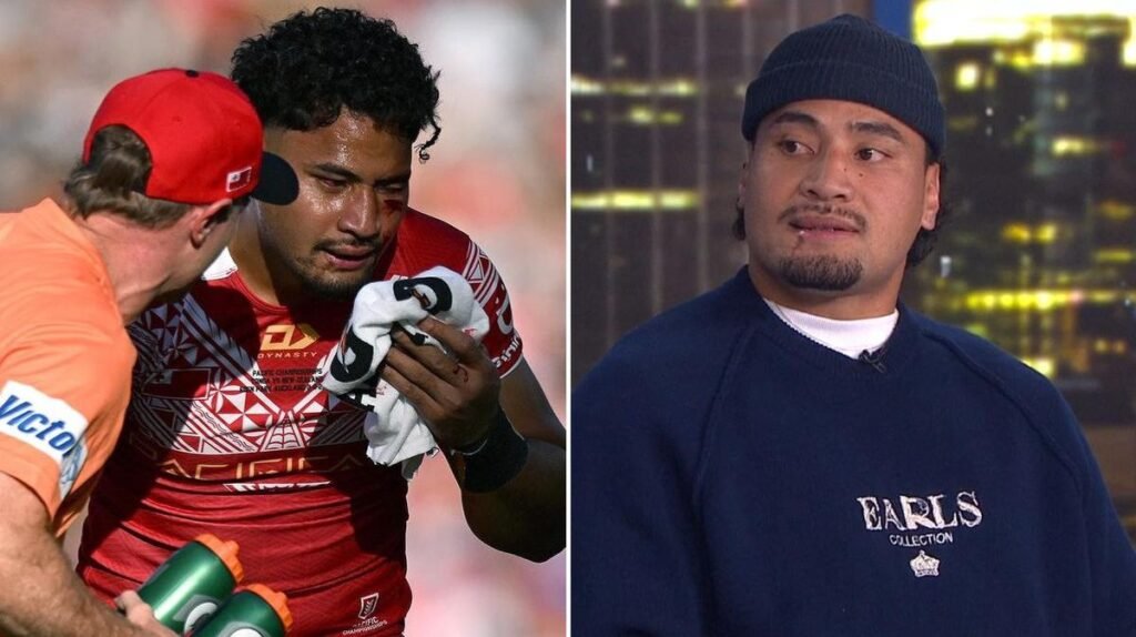 La estrella de Melbourne Storm, Eli Katoa, todavía espera regresar