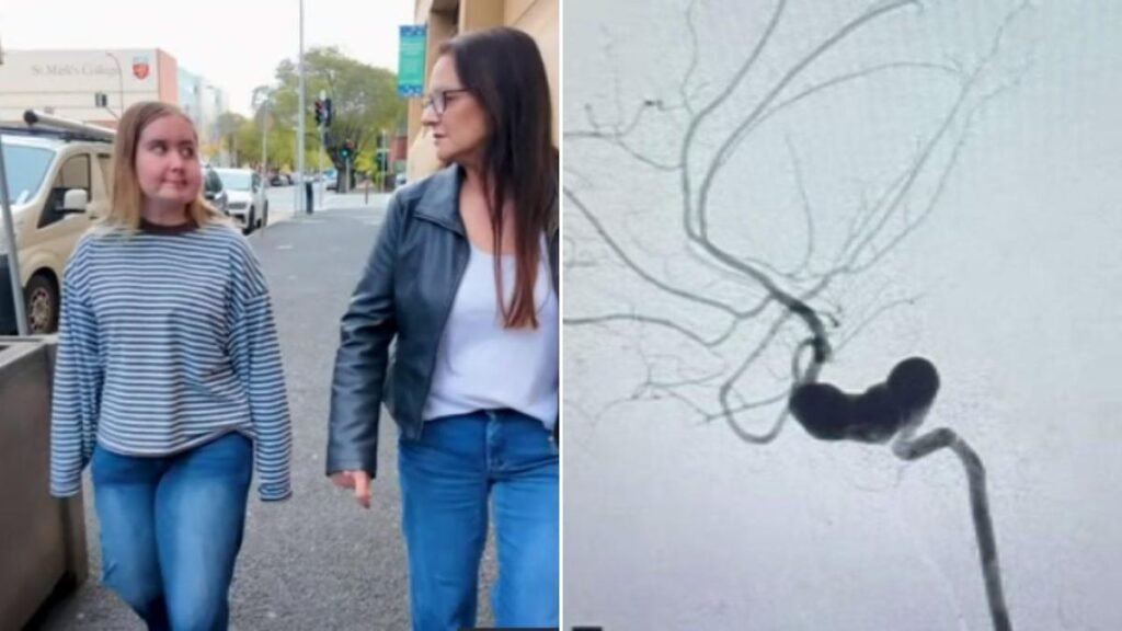 Los neurocirujanos se están preparando para una operación vital para