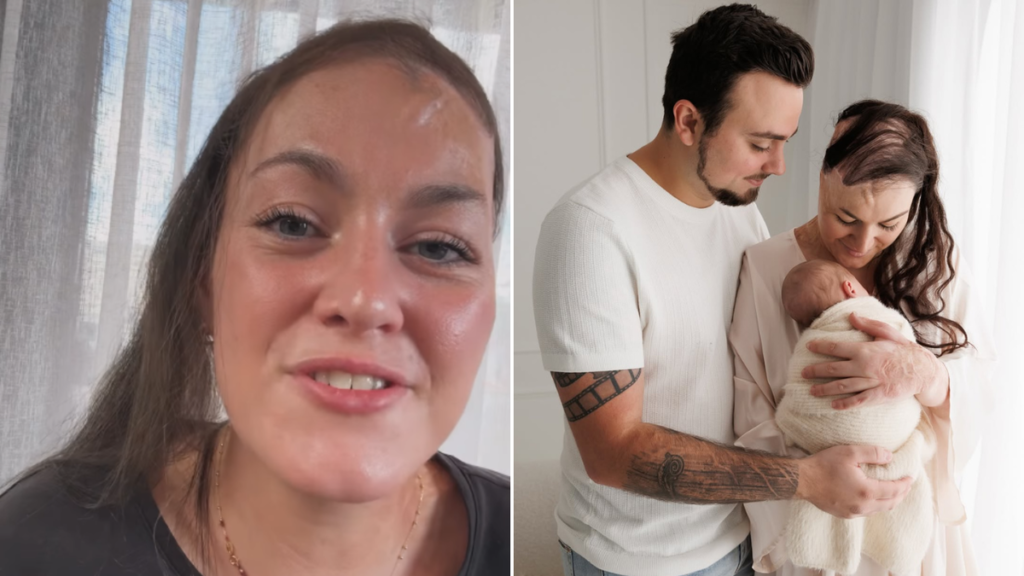 Sophie Delezio, sobreviviente de quemaduras, ha anunciado un nuevo cambio