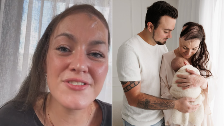 Sophie Delezio, sobreviviente de quemaduras, ha anunciado un nuevo cambio