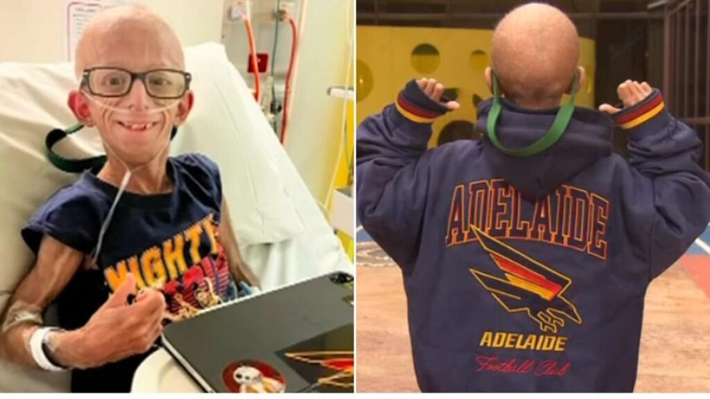 Un adolescente vulnerable de Adelaida insta a los australianos enfermos