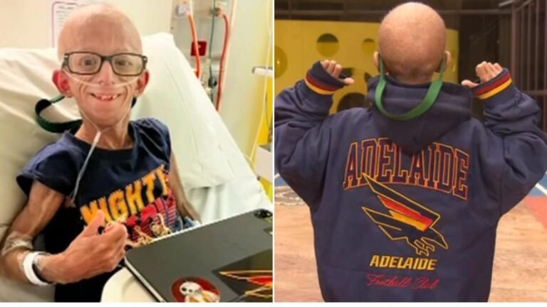 Un adolescente vulnerable de Adelaida insta a los australianos enfermos