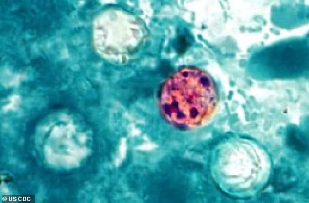 Une épidémie parasitaire rend 145 personnes malades dans 17 États