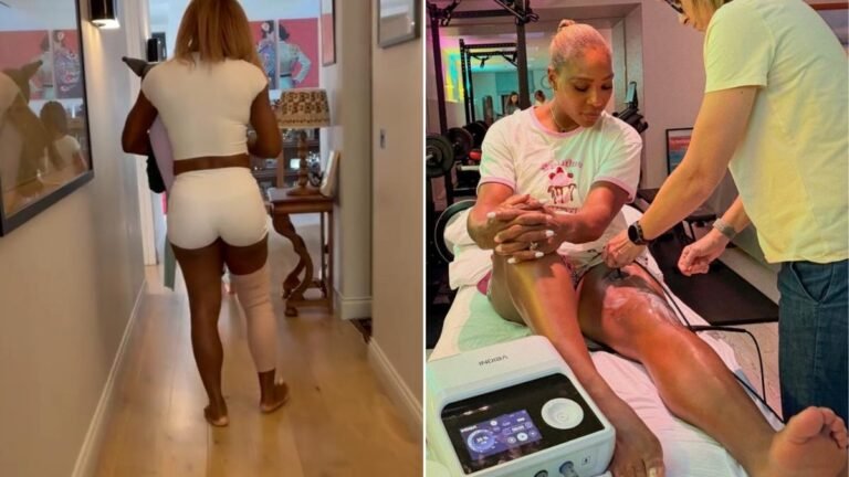 El regreso de Serena Williams de una operación de rodilla