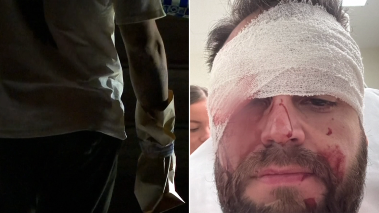 Le cortaron la boca a un hombre acusado de destrozar