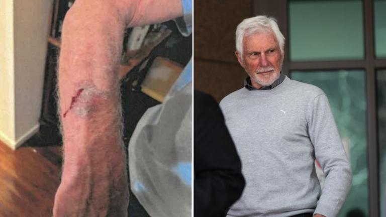 Mick Malthouse: Fotos impactantes revelan las lesiones del gran AFL