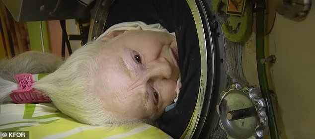 Une femme de 78 ans, dernière survivante de la polio